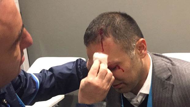Ziraat Türkiye Kupası maçında Fenerbahçe menajerinin kafası yarıldı