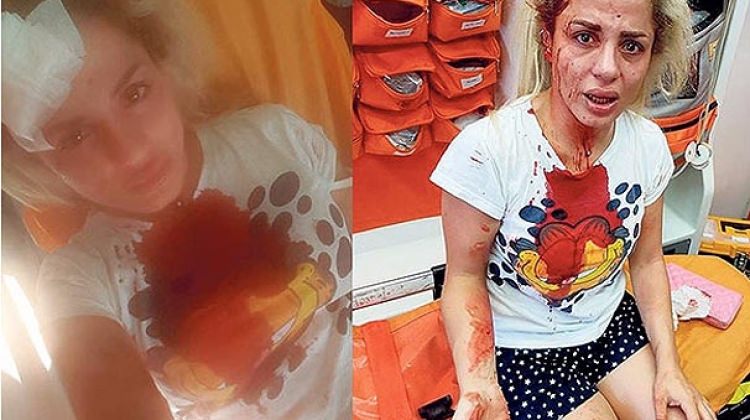 Yer İstanbul: 'Kıyafetine bak' deyip dövdü, taciz etti ve şimdi aramızda!