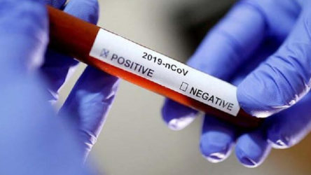 Dünya genelinde koronavirüsü yenenlerin sayısı 871 bin 265'e yükseldi