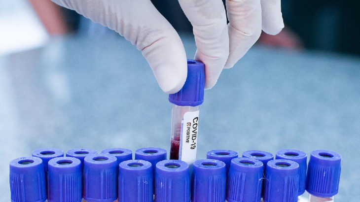 İstanbul Tıp Fakültesi'nde antikor testlerine başlandı