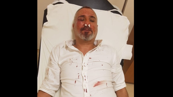 Yazıdan rahatsız olan AKP'liler gazeteciyi dövdü