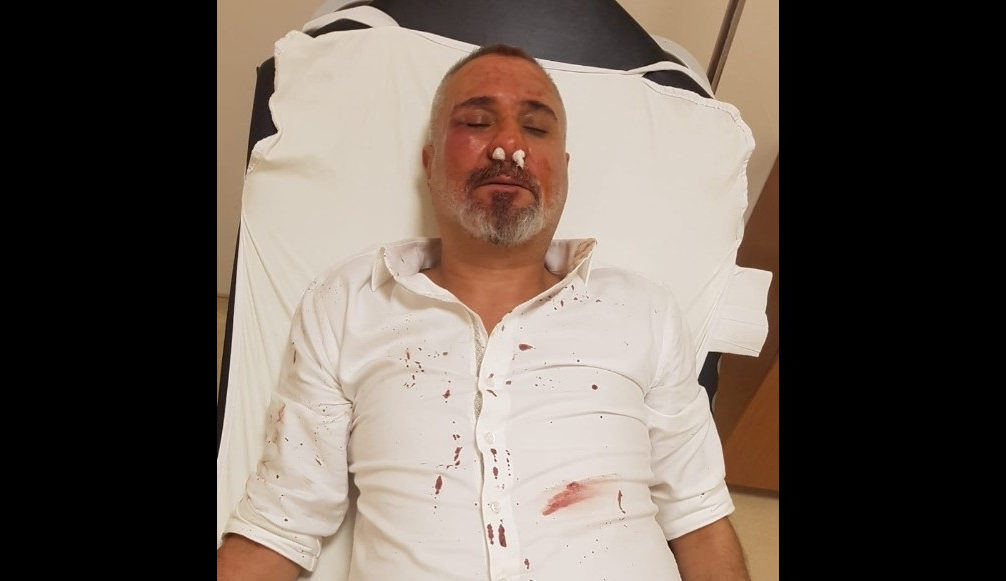 Yazıdan rahatsız olan AKP'liler gazeteciyi dövdü