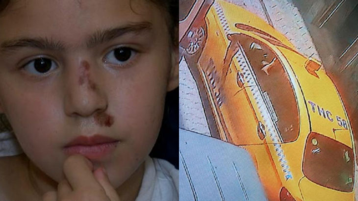 İstanbul'da sarı terör devam ediyor: 9 yaşındaki çocuğa çarptı, çocuğu hastaneye bırakıp kaçtı
